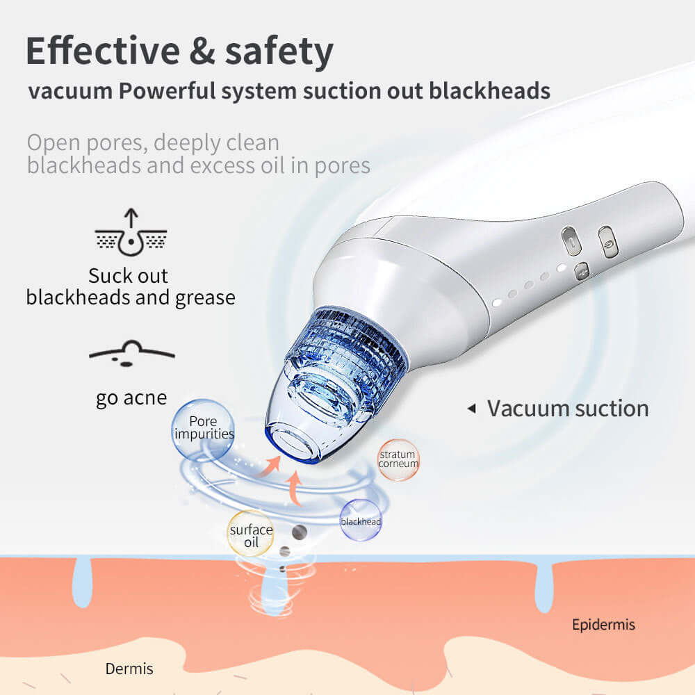 Electric Blackhead Remover & Acne Suction Tool for Home Use