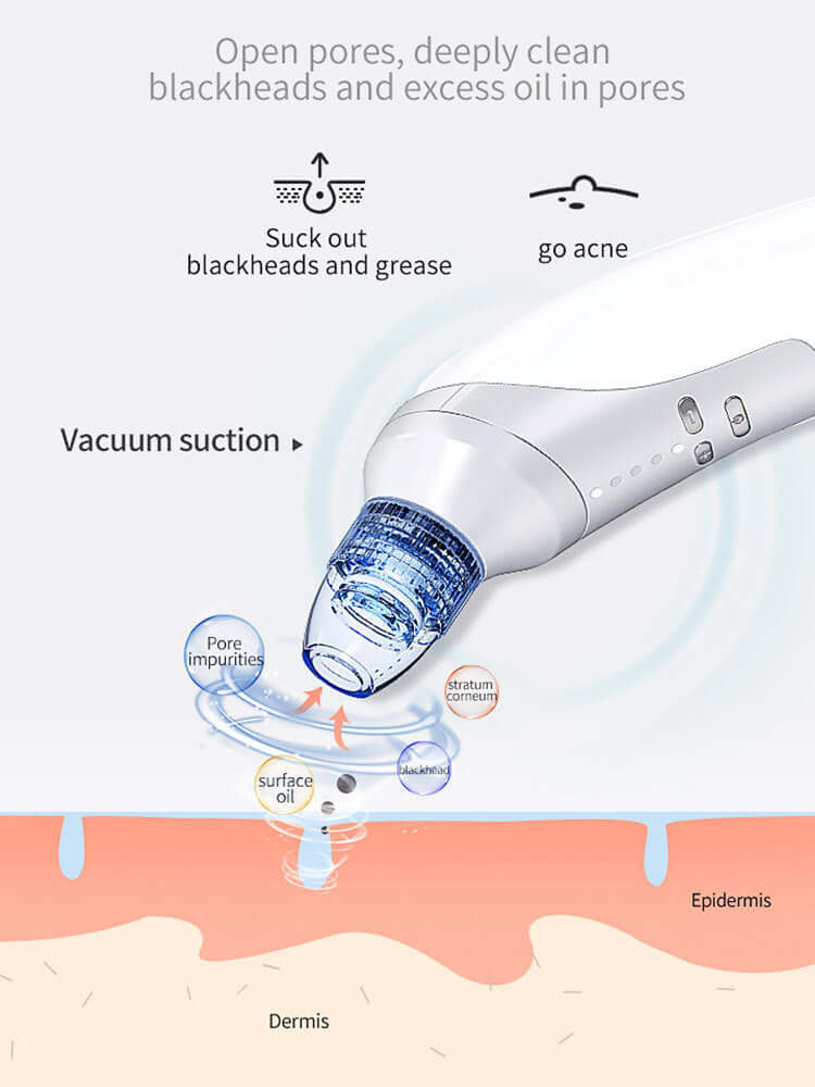 Electric Blackhead Remover & Acne Suction Tool for Home Use